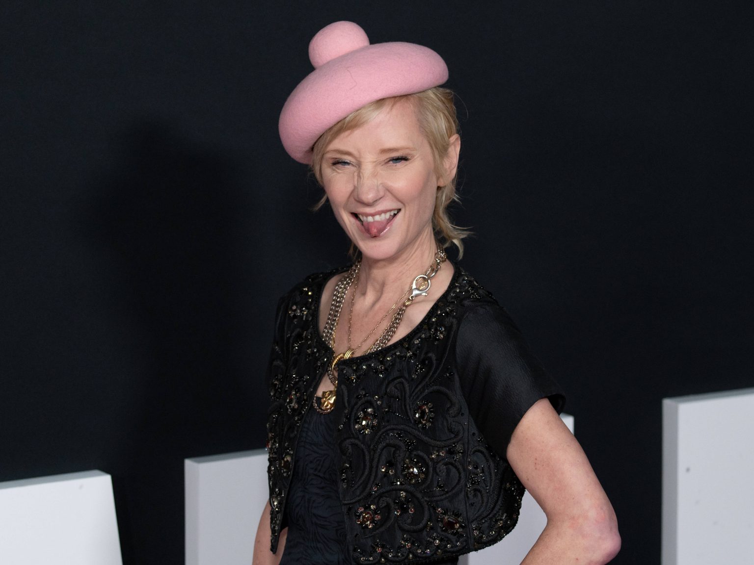 Anne Heche: „Tod!“ – Die Schauspielerin stirbt an den dramatischen Folgen ihres Unfalls!