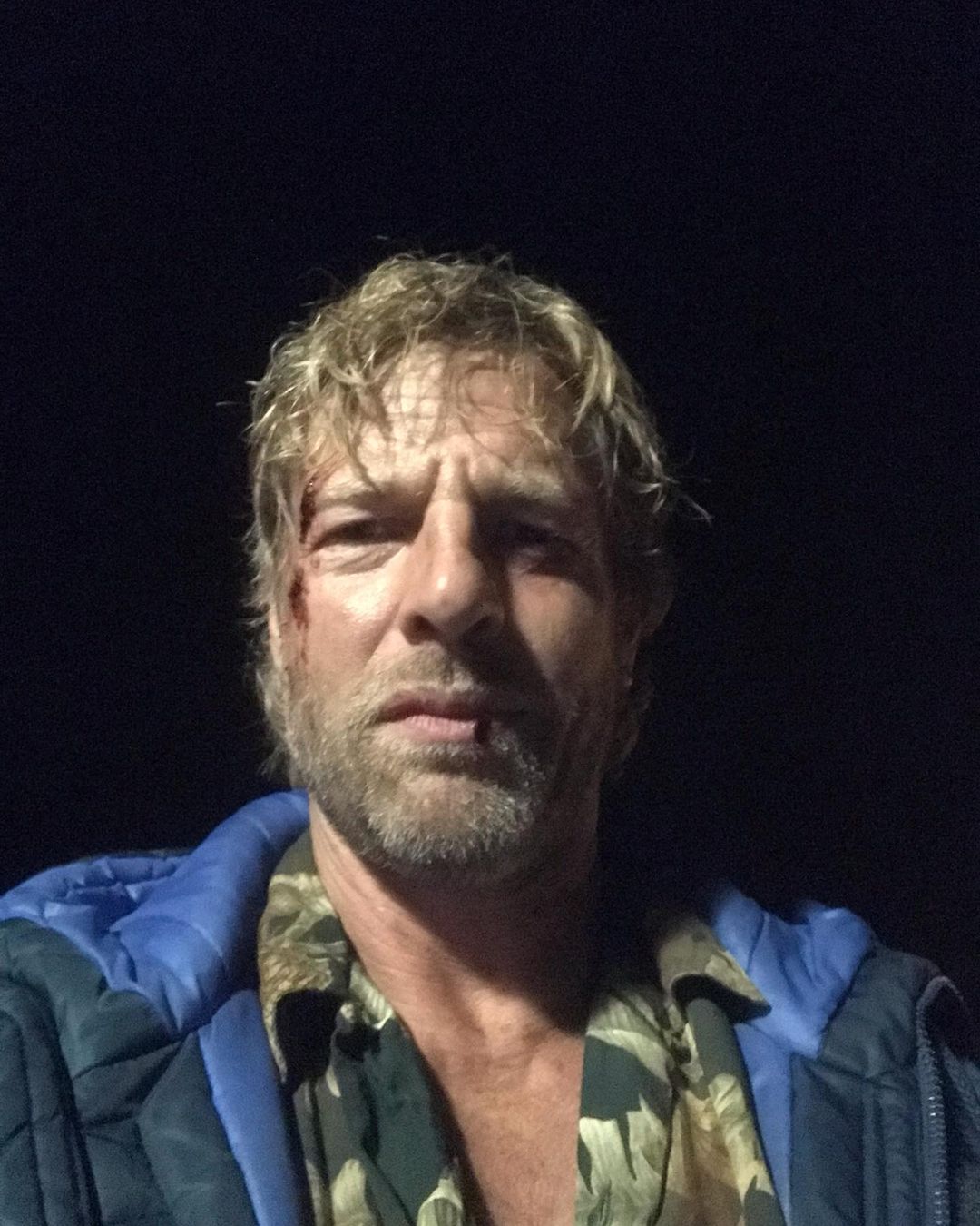 Dramatischer Unfall bei Sat.1 – Show: Schauspieler wird sofort in die Notaufnahme eingeliefert!