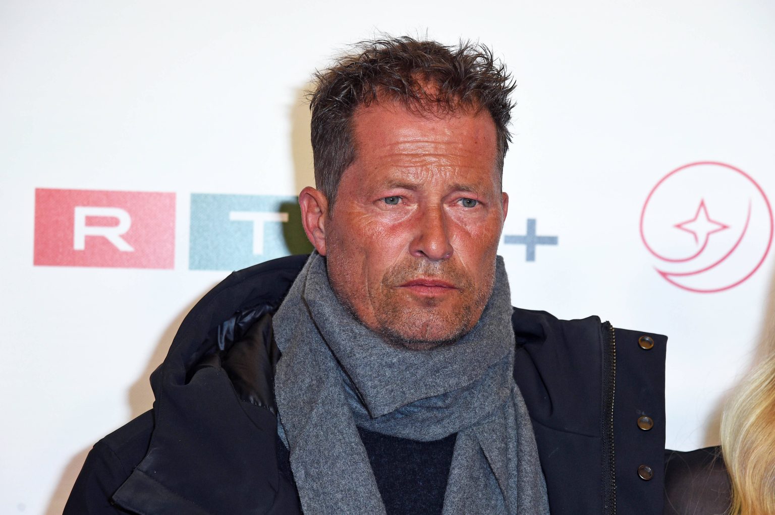 Til Schweiger total verändert: Seine Beauty-Ärztin enthüllt, was wirklich gemacht wurde